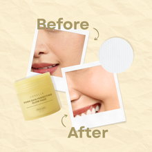 Load image into Gallery viewer, Luxelle PDRN Skin Perfecting Glow Pads 80 Gel Pads
